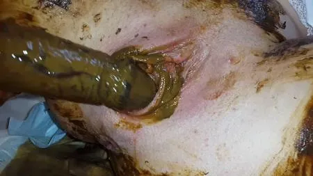 Porn Anna Coprofield - Gynecological Self-Examination Shit - Filled Pussy Thought The Speculum FullHD 1080p (Pee, Solo, Shit) scat-shop.com