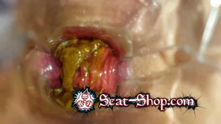 Porn Anna Coprofield - Speculum Play and Filled Pussy part 1 FullHD 1080p (Scatology, Solo) scat-shop.com