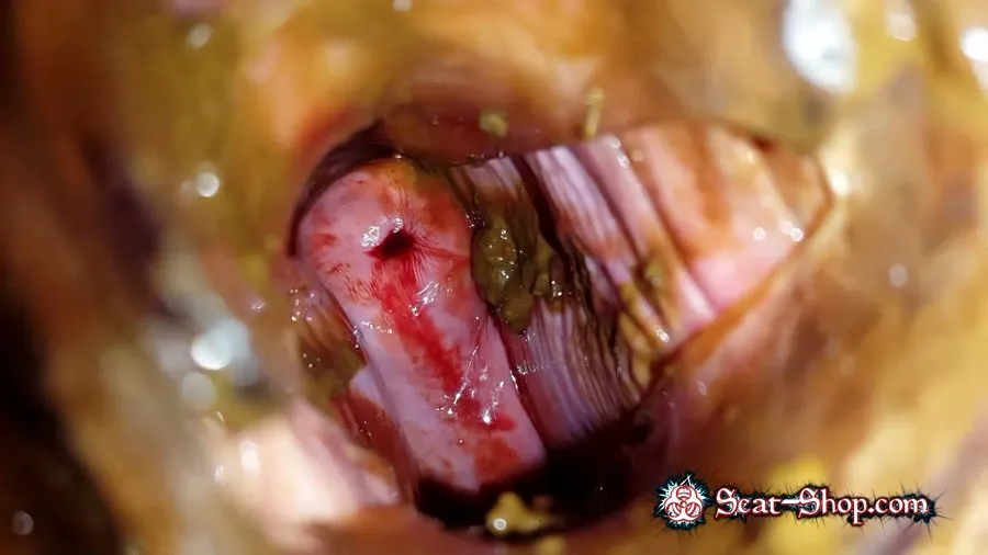 Anna Coprofield - Shit and Blood Vol.5 Speculum Full version FullHD 1080p (Slander, Bull, Solo)