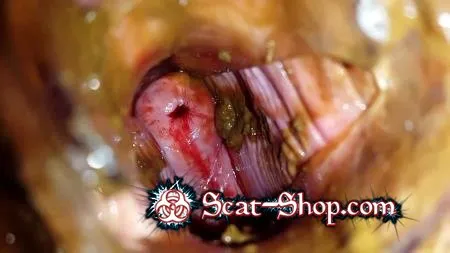 Porn Anna Coprofield - Shit and Blood Vol.5 Speculum Full version FullHD 1080p (Slander, Bull, Solo) scat-shop.com