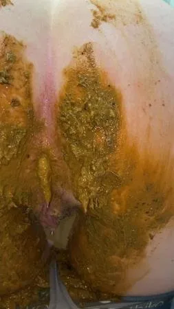 Porn Sexandcandy18 - Extreme jean accident UltraHD 2K (Scatology, Solo) scat-shop.com