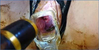 Anna Coprofield Self-Explores with Speculum and Scat During Menstruation