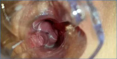 Anna Coprofield Solo: Speculum Filled Pussy Packed with Messy Copro