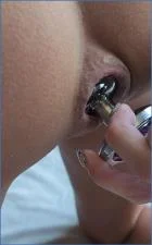 LilbuttLex Fists Her Gaping Asshole - Extreme Anal Scat Ride