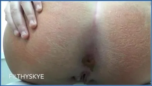 Copro: Filthy Skye Compilation With Wide Gape And Scat